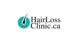 hair loss clinic toronto 300x169